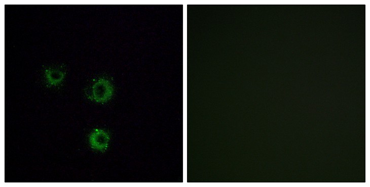 Fig2:; Immunofluorescence analysis of MCF7 cells, using TAS2R14 Antibody. The picture on the right is blocked with the synthesized peptide.