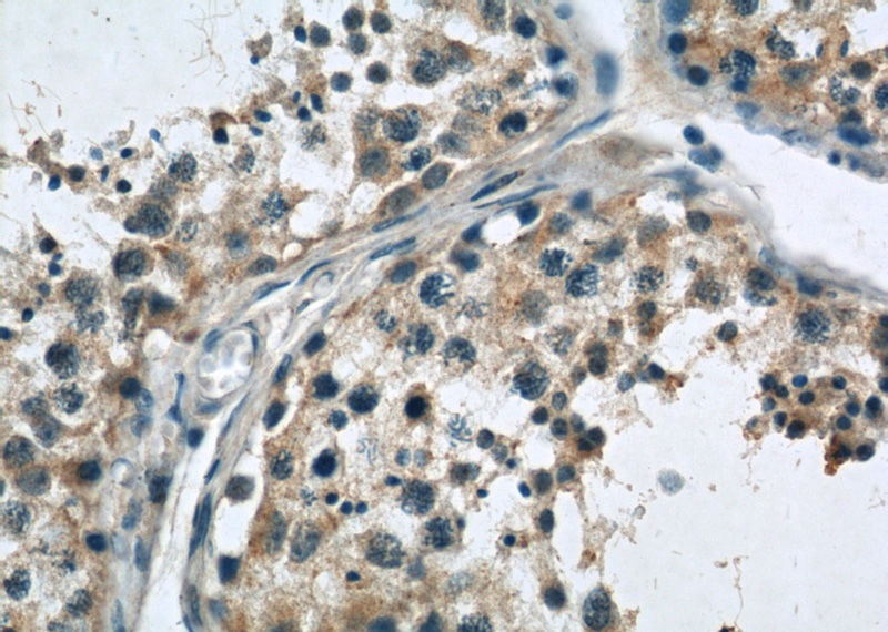 Immunohistochemistry of paraffin-embedded human testis slide using Catalog No:114974(SASS6 Antibody) at dilution of 1:50