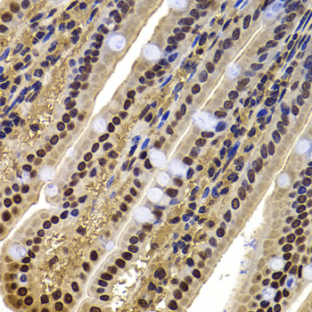 Immunohistochemistry - ACTL6B Polyclonal Antibody 