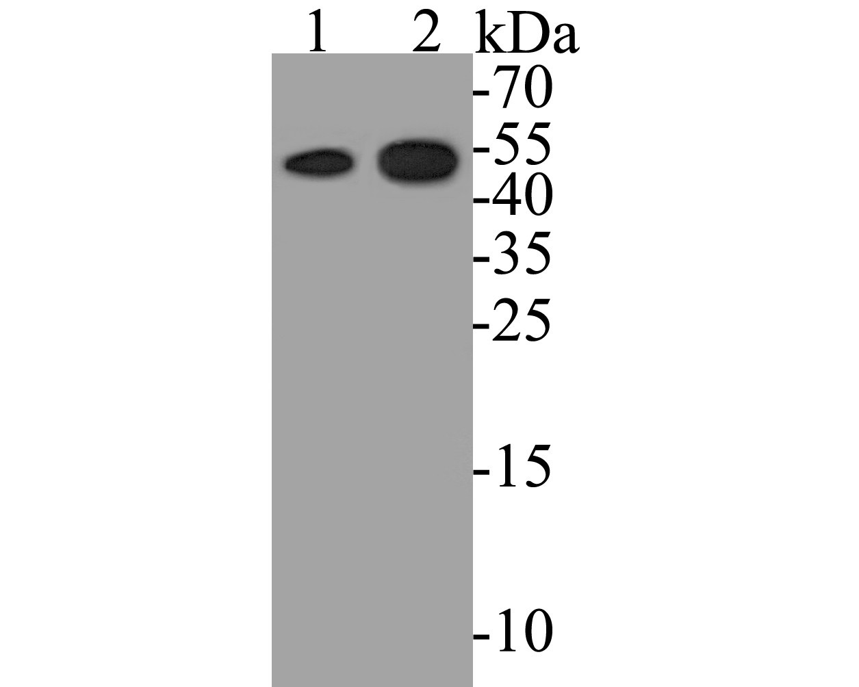 Fig1: Western blot analysis of ZAC on different lysates. Proteins were transferred to a PVDF membrane and blocked with 5% BSA in PBS for 1 hour at room temperature. The primary antibody ( 1/500) was used in 5% BSA at room temperature for 2 hours. Goat Anti-Rabbit IgG - HRP Secondary Antibody (HA1001) at 1:5,000 dilution was used for 1 hour at room temperature.; Positive control:; Lane 1: human kidney tissue lysate; Lane 2: HepG2 cell lysate