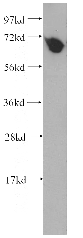 HeLa cells were subjected to SDS PAGE followed by western blot with Catalog No:111912(KARS antibody) at dilution of 1:400