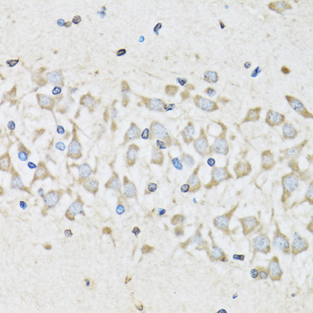 Immunohistochemistry - NUDC Polyclonal Antibody 