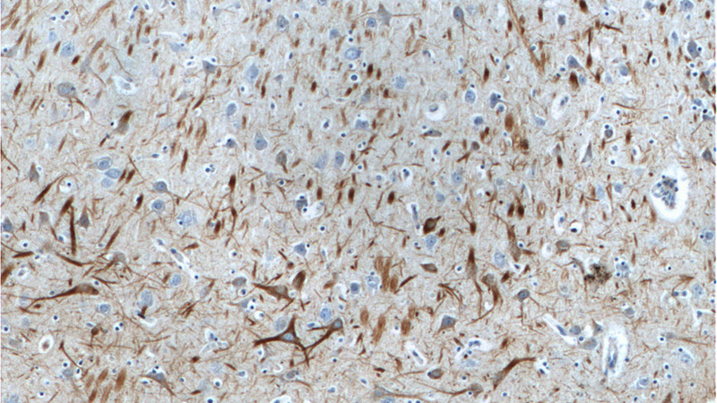 Immunohistochemistry of paraffin-embedded human brain tissue slide using Catalog No:113162(NEFL Antibody) at dilution of 1:200 (under 10x lens)