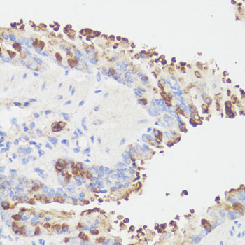Immunohistochemistry - EEF1G Polyclonal Antibody 
