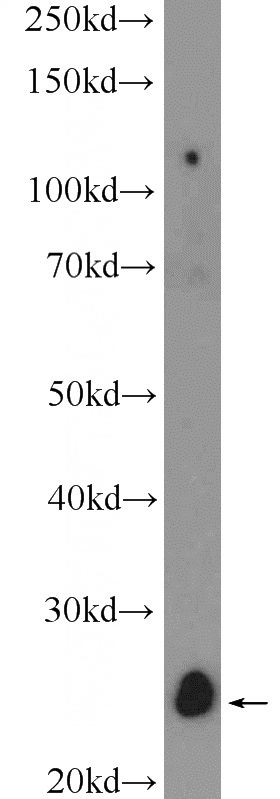 mouse brain tissue were subjected to SDS PAGE followed by western blot with Catalog No:108649(C12orf69 Antibody) at dilution of 1:600