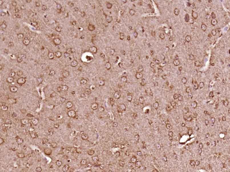 Fig2: Paraformaldehyde-fixed, paraffin embedded (Mouse brain); Antigen retrieval by boiling in sodium citrate buffer (pH6.0) for 15min; Block endogenous peroxidase by 3% hydrogen peroxide for 20 minutes; Blocking buffer (normal goat serum) at 37℃ for 30min; Antibody incubation with (SPIN4) Polyclonal Antibody, Unconjugated at 1:400 overnight at 4℃, followed by operating according to SP Kit(Rabbit) (sp-0023) instructionsand DAB staining.