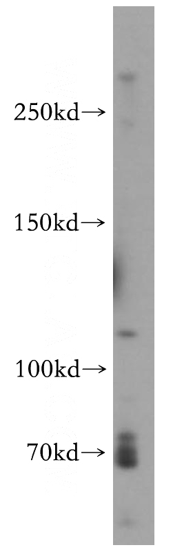 Jurkat cells were subjected to SDS PAGE followed by western blot with Catalog No:116811(VWF, VWFpp antibody) at dilution of 1:500