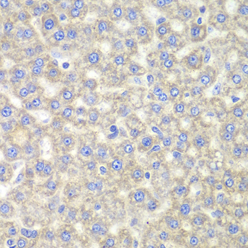 Immunohistochemistry - EYA3 Polyclonal Antibody 