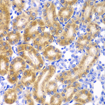 Immunohistochemistry - RPN1 Polyclonal Antibody 