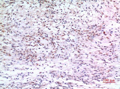 Fig2:; Immunohistochemical analysis of paraffin-embedded human-brain, antibody was diluted at 1:100