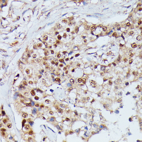 Immunohistochemistry - IGHMBP2 Polyclonal Antibody 