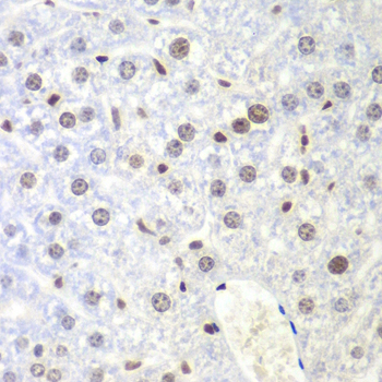 Immunohistochemistry - UHRF2 Polyclonal Antibody 