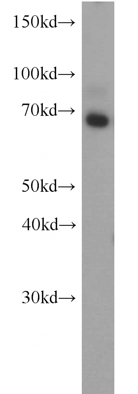 HeLa cells were subjected to SDS PAGE followed by western blot with Catalog No:117115(BEGAIN antibody) at dilution of 1:1000