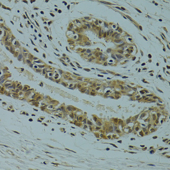 Immunohistochemistry - RSRC1 Polyclonal Antibody 