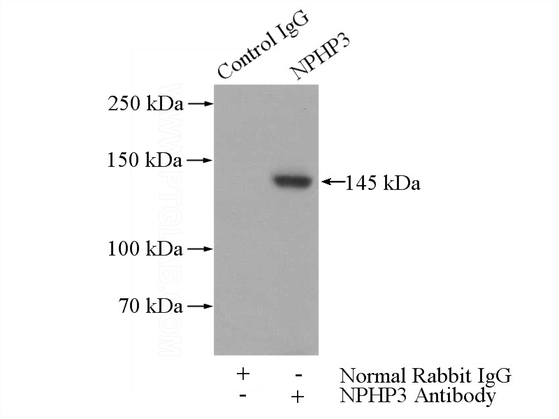 IP Result of anti-NPHP3 (IP:Catalog No:113213, 4ug; Detection:Catalog No:113213 1:1000) with mouse testis tissue lysate 4000ug.