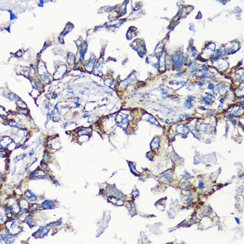 Immunohistochemistry - MMP16 Polyclonal Antibody 