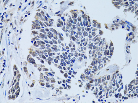 Immunohistochemistry - SIN3A Polyclonal Antibody 