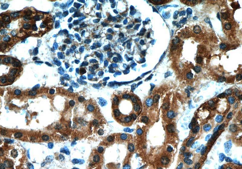 Immunohistochemical of paraffin-embedded human kidney using Catalog No:113412(NUDCD2 antibody) at dilution of 1:100 (under 40x lens)