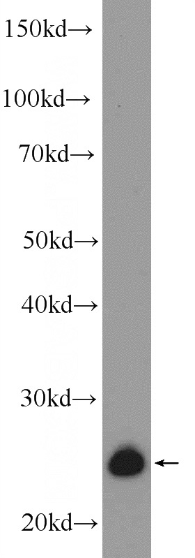 SH-SY5Y cells were subjected to SDS PAGE followed by western blot with Catalog No:117066(ZMAT2 Antibody) at dilution of 1:600