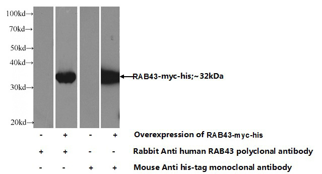 Transfected HEK-293 cells were subjected to SDS PAGE followed by western blot with Catalog No:114451(RAB43 Antibody) at dilution of 1:1000