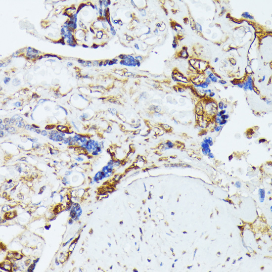 Immunohistochemistry - COX15 Polyclonal Antibody 