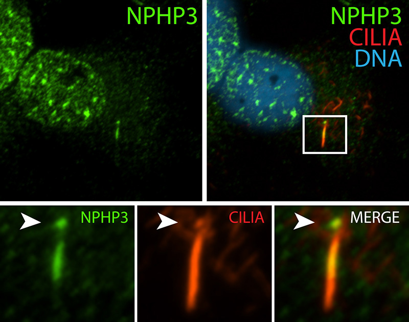 IF result (the base and the lower half of cilia stain) of anti-NPHP3 (Catalog No:113213, 1:50) with serum-starved hTERT-RPE1 (MeOH fixed) by Dr. Moshe Kim.