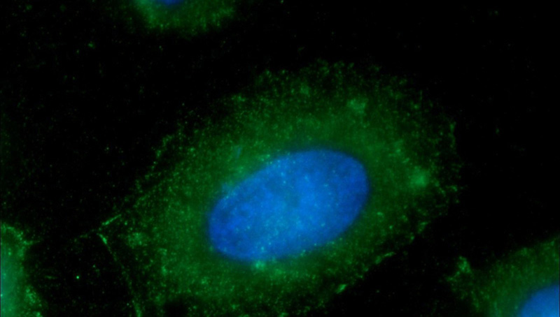Immunofluorescent analysis of MCF-7 cells using Catalog No:107136(CD44 Antibody) at dilution of 1:25 and Alexa Fluor 488-congugated AffiniPure Goat Anti-Mouse IgG(H+L)