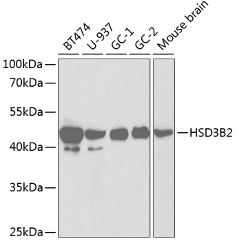 Western blot - HSD3B2 Polyclonal Antibody 