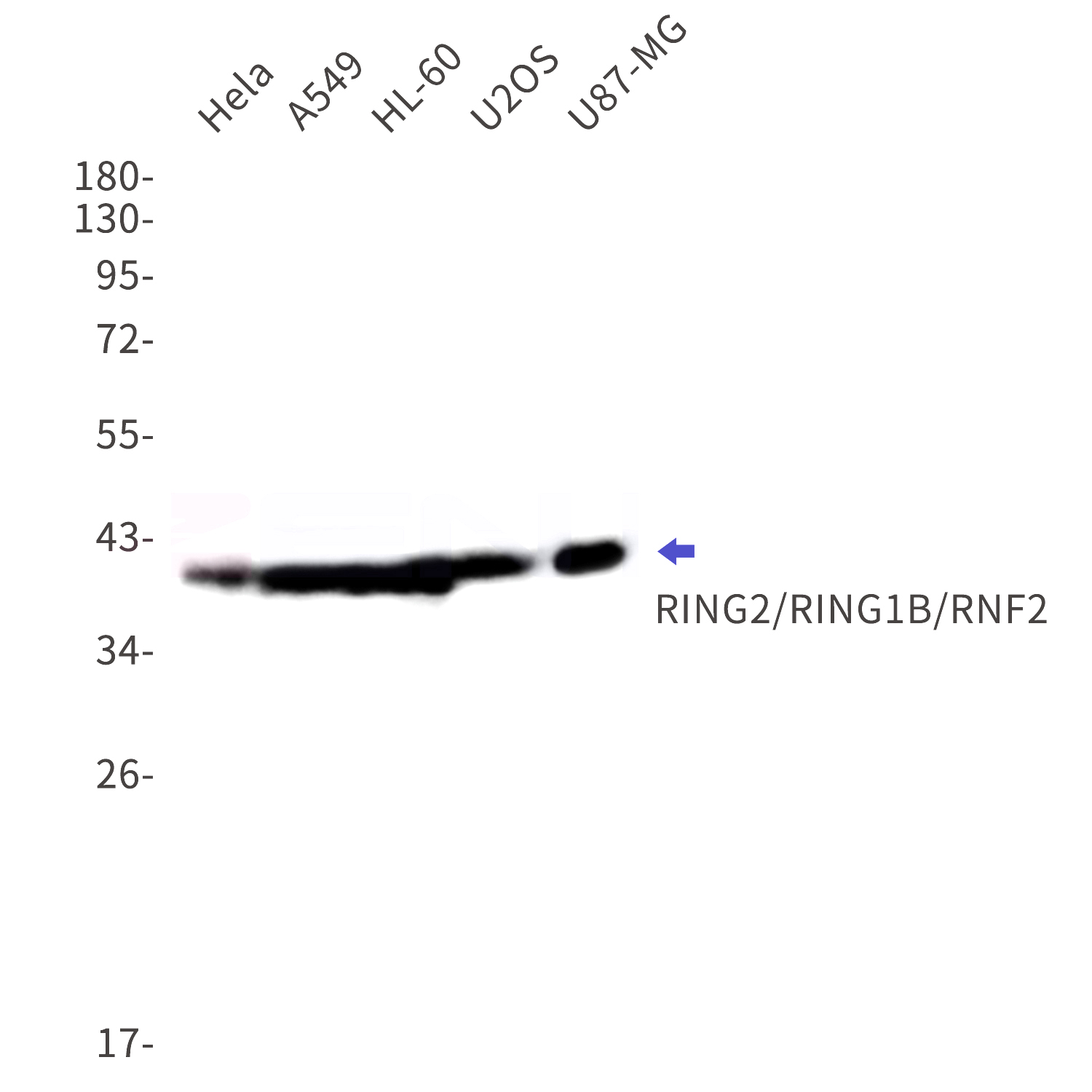 Western blot detection of RING2/RING1B/RNF2 in Hela,A549,HL-60,U2OS,U87-MG cell lysates using RING2/RING1B/RNF2 Rabbit mAb(1:1000 diluted).Observed band size:38kDa.