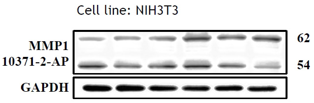 WB results of MMP1 antibody (Catalog No:, 1:500) with NIH3T3 cells, 62 kDa for pro-MMP1 and 54 kDa for Active MMP1. Data from Dr. Hui-Wen Chiu, Taipei Medical University.