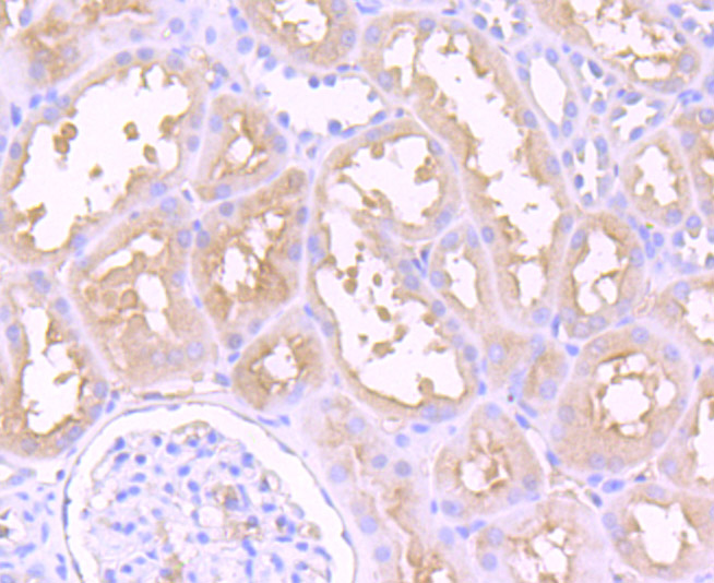 Fig2: Immunohistochemical analysis of paraffin-embedded human kidney tissue using anti-Dysferlin antibody. Counter stained with hematoxylin.