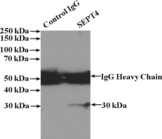 IP Result of anti-SEPT4 (IP:Catalog No:115118, 4ug; Detection:Catalog No:115118 1:300) with A375 cells lysate 2200ug.