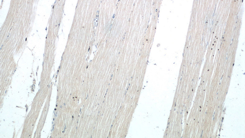 Immunohistochemistry of paraffin-embedded human skeletal muscle tissue slide using Catalog No:115007(SCN4B Antibody) at dilution of 1:50 (under 10x lens)