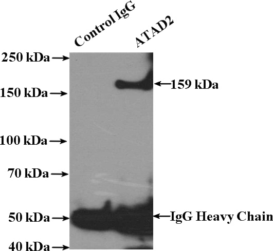 IP Result of anti-ATAD2 (IP:Catalog No:108277, 4ug; Detection:Catalog No:108277 1:500) with HeLa cells lysate 3200ug.