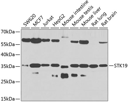 Western blot - STK19 Polyclonal Antibody 