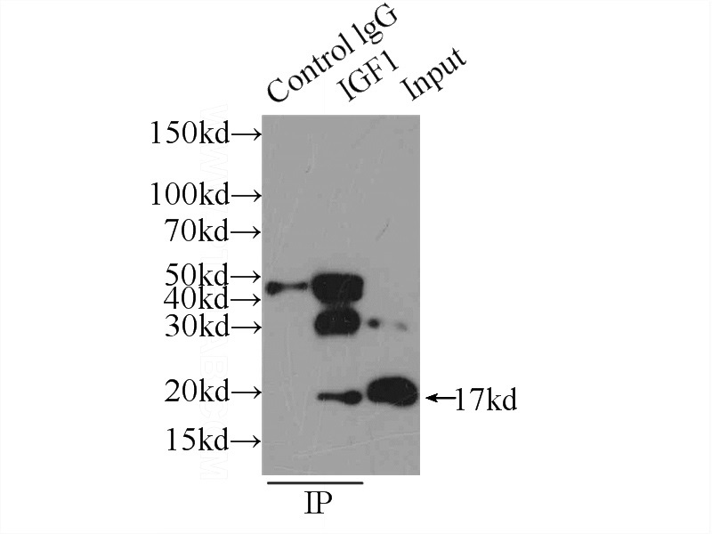 IP Result of anti-IGF1A-Specific (IP:Catalog No:111676, 3ug; Detection:Catalog No:111676 1:300) with mouse liver tissue lysate 5000ug.