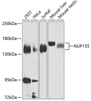 Western blot - NUP155 Polyclonal Antibody 