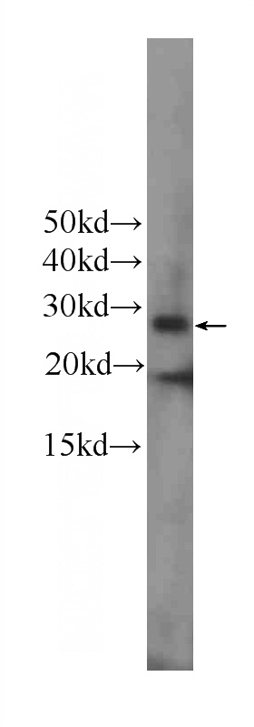 Jurkat cells were subjected to SDS PAGE followed by western blot with Catalog No:107128(CD3D Antibody) at dilution of 1:500
