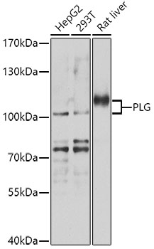 Western blot - PLG Polyclonal Antibody 