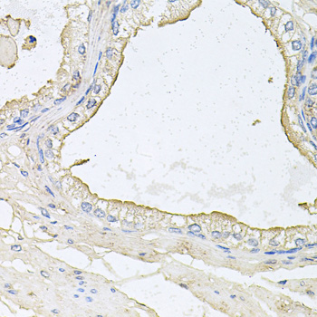 Immunohistochemistry - HPR Polyclonal Antibody 
