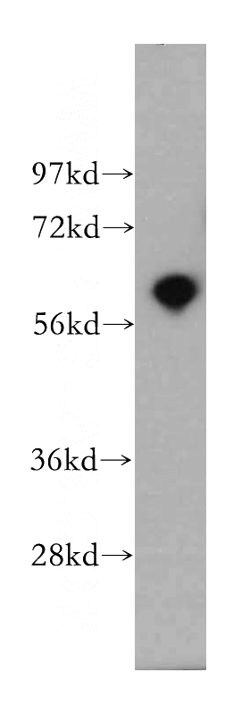 human brain tissue were subjected to SDS PAGE followed by western blot with Catalog No:113657(PDE1A antibody) at dilution of 1:500