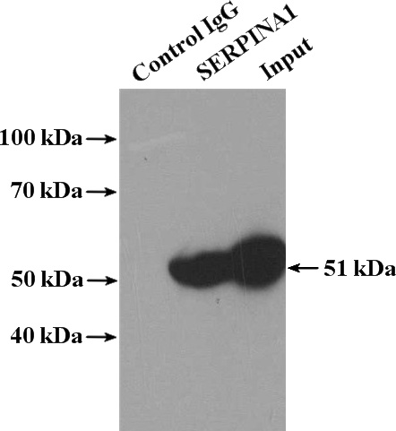 IP Result of anti-Alpha-1-Antitrypsin (IP:Catalog No:107580, 5ug; Detection:Catalog No:107580 1:1000) with human plasma tissue lysate 4000ug.