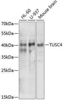Western blot - NPRL2 Polyclonal Antibody 