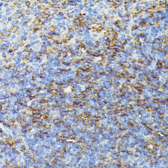 Immunohistochemistry - COX15 Polyclonal Antibody 