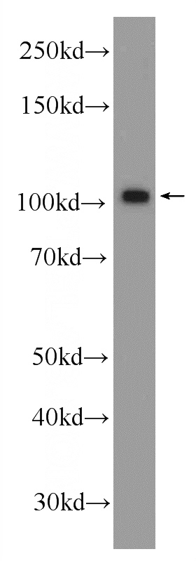 HeLa cells were subjected to SDS PAGE followed by western blot with Catalog No:117223(BRCA1 Antibody) at dilution of 1:1000