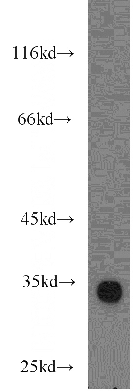 mouse testis tissue were subjected to SDS PAGE followed by western blot with Catalog No:109956(DNALI1 antibody) at dilution of 1:3000