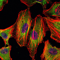 Immunofluorescence analysis of Hela cells using STAT3 mouse mAb (green). Blue