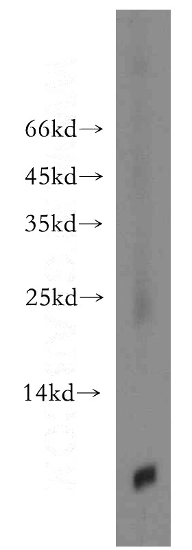 human skeletal muscle tissue were subjected to SDS PAGE followed by western blot with Catalog No:116280(TMSB4X antibody) at dilution of 1:2000