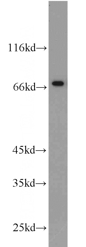 rat testis tissue were subjected to SDS PAGE followed by western blot with Catalog No:115530(SPAG16 antibody) at dilution of 1:1000