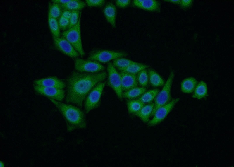 Immunofluorescent analysis of HeLa cells using Catalog No:116764(VMO1 Antibody) at dilution of 1:50 and Alexa Fluor 488-congugated AffiniPure Goat Anti-Rabbit IgG(H+L)
